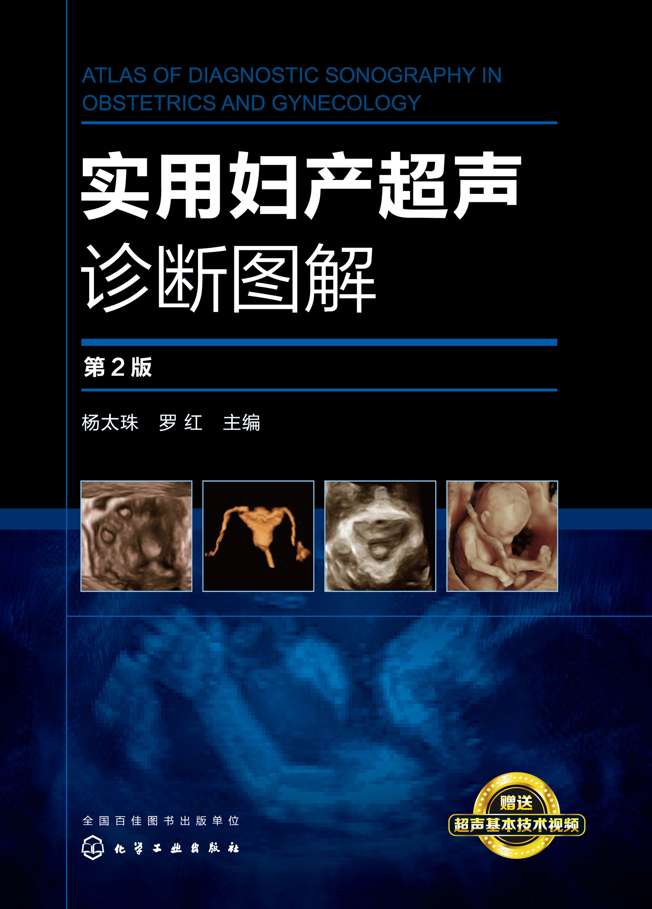 实用妇产超声诊断图解