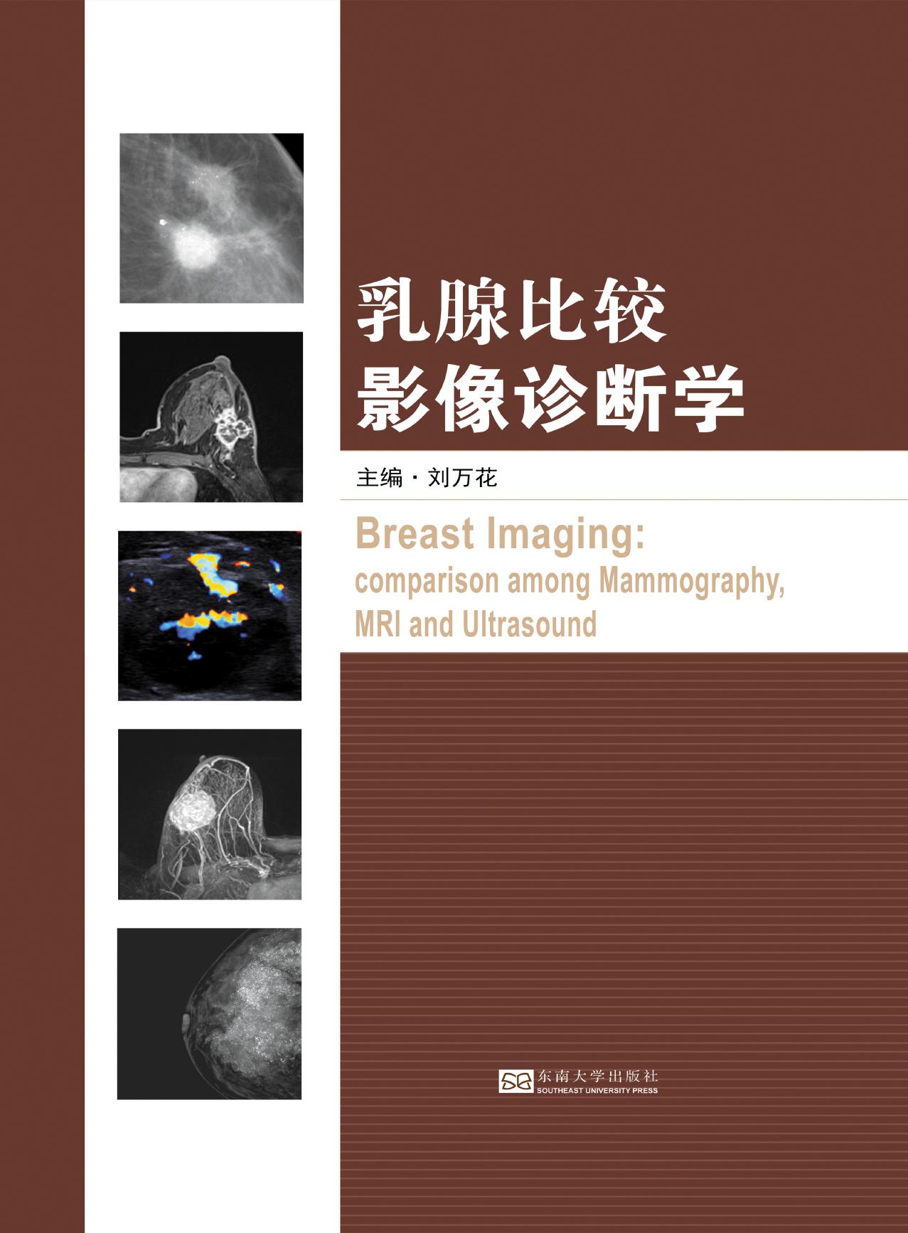 乳腺比较影像诊断学