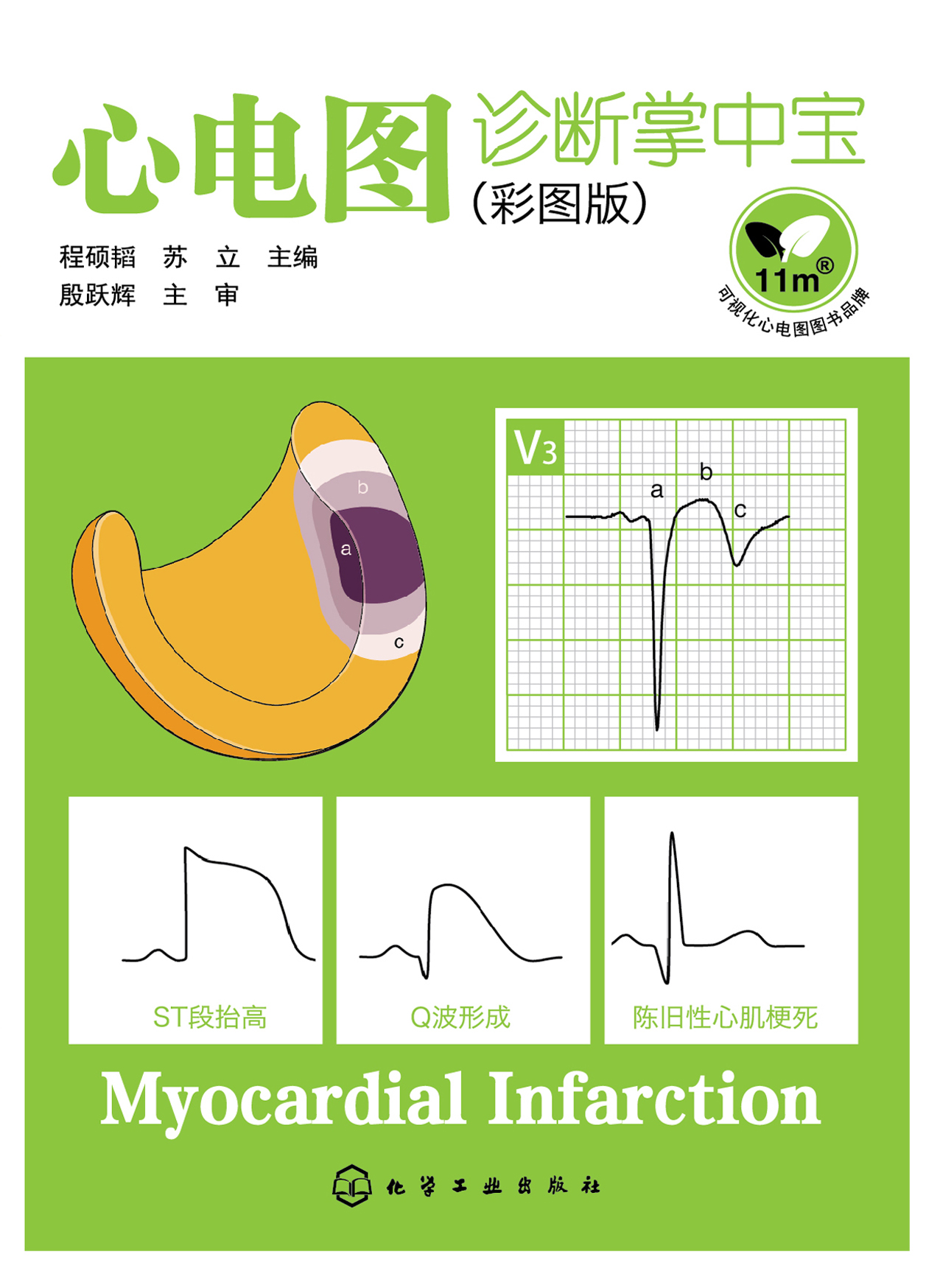 心电图诊断掌中宝（彩图版）